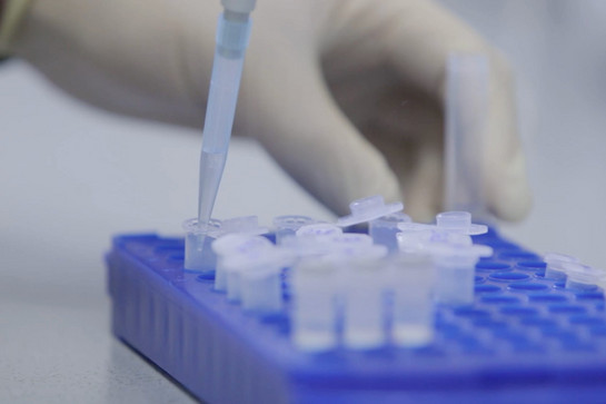 Eine Pipette saugt Flüssigkeit auf