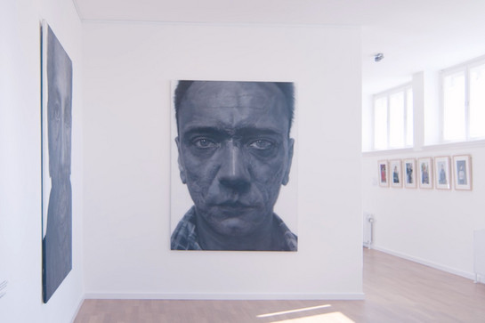 Portrait eines Mannes mit stark vernarbtem Gesicht und leidvollem Ausdruck.