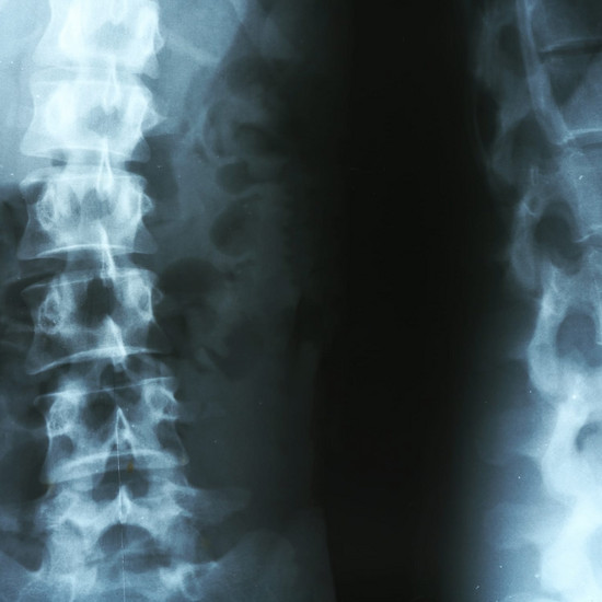 Nahaufnahme eines Röntgenbild