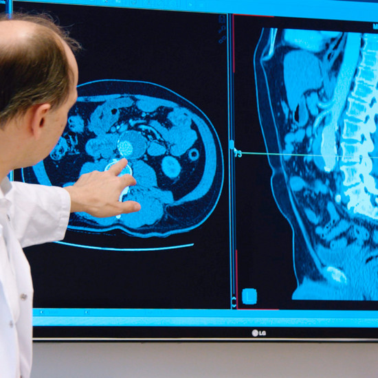 Ein Mann zeigt auf ein CT Bild