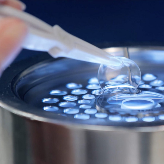 Eine Kontaktlinse wird in eine Flüssigkeit gelegt