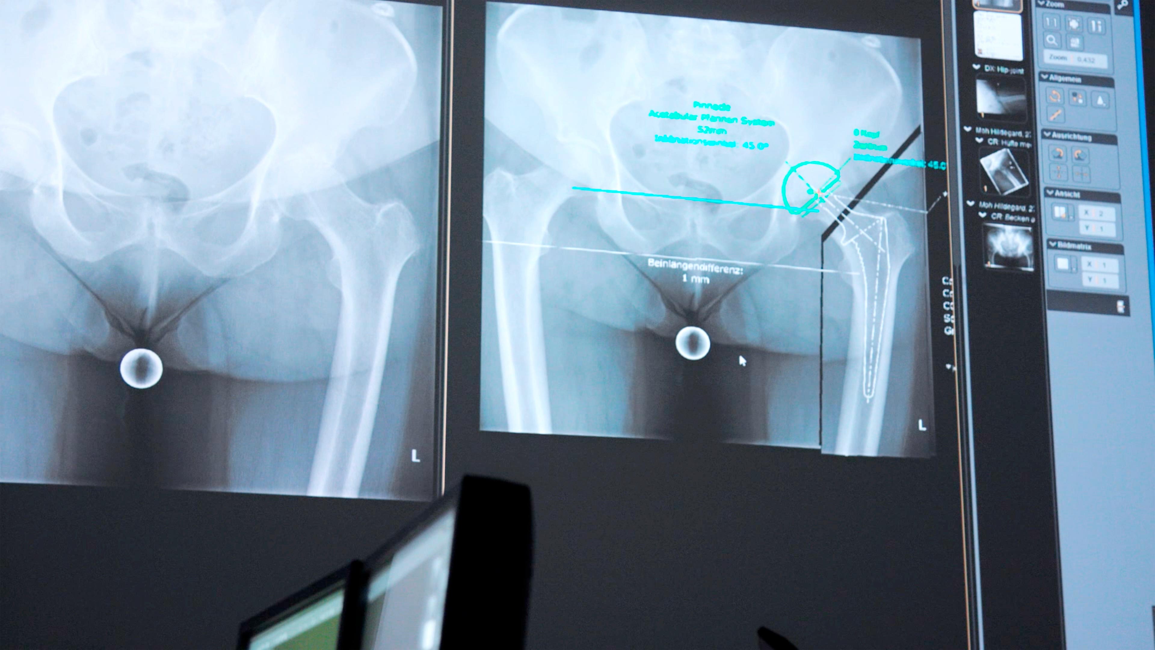 Zwei CT Bilder hängen an einer Wand